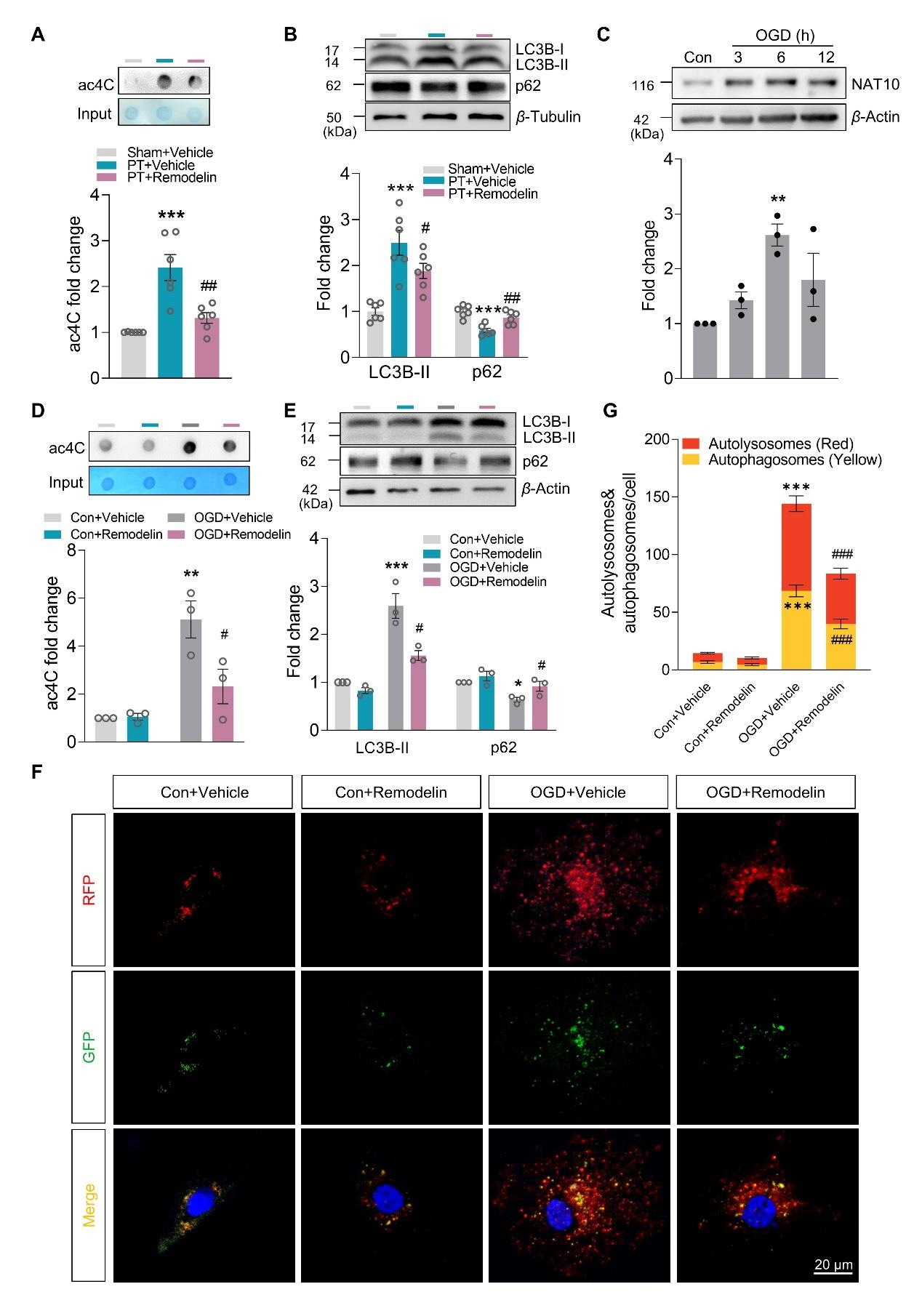 NAT10通过ac4C修饰参与自噬