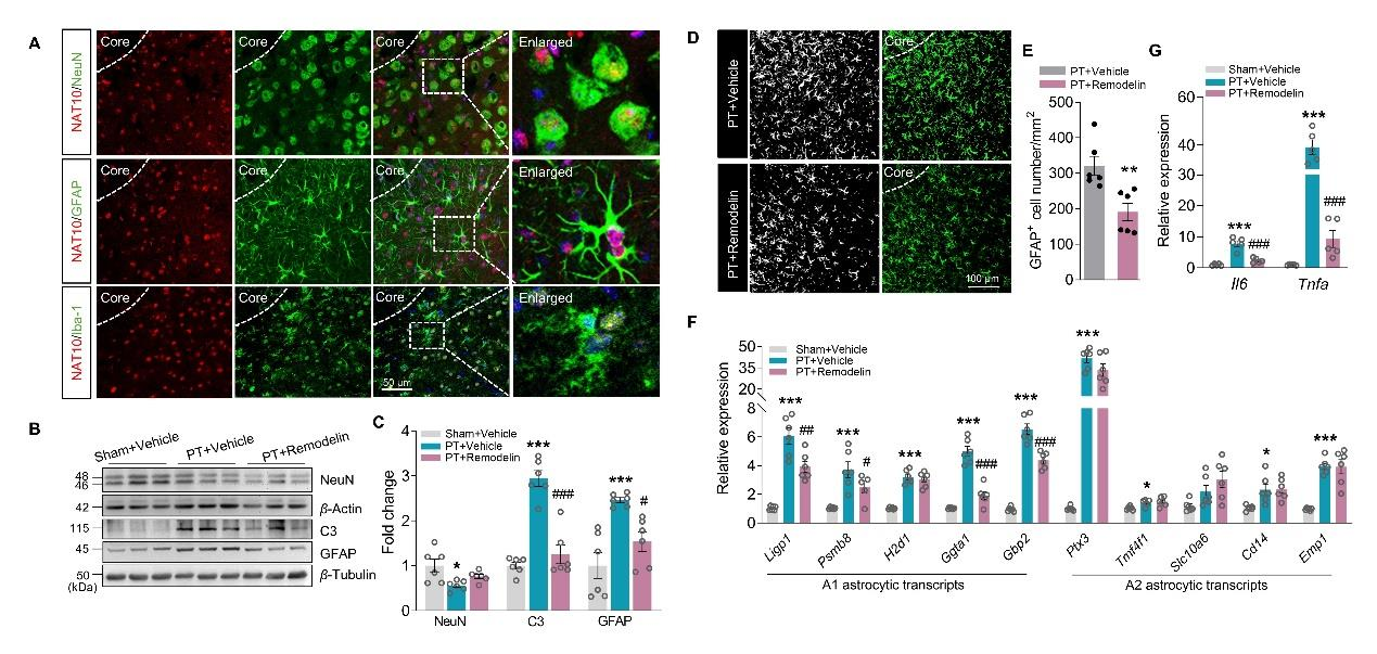 抑制NAT10可降低梗死周围神经毒性