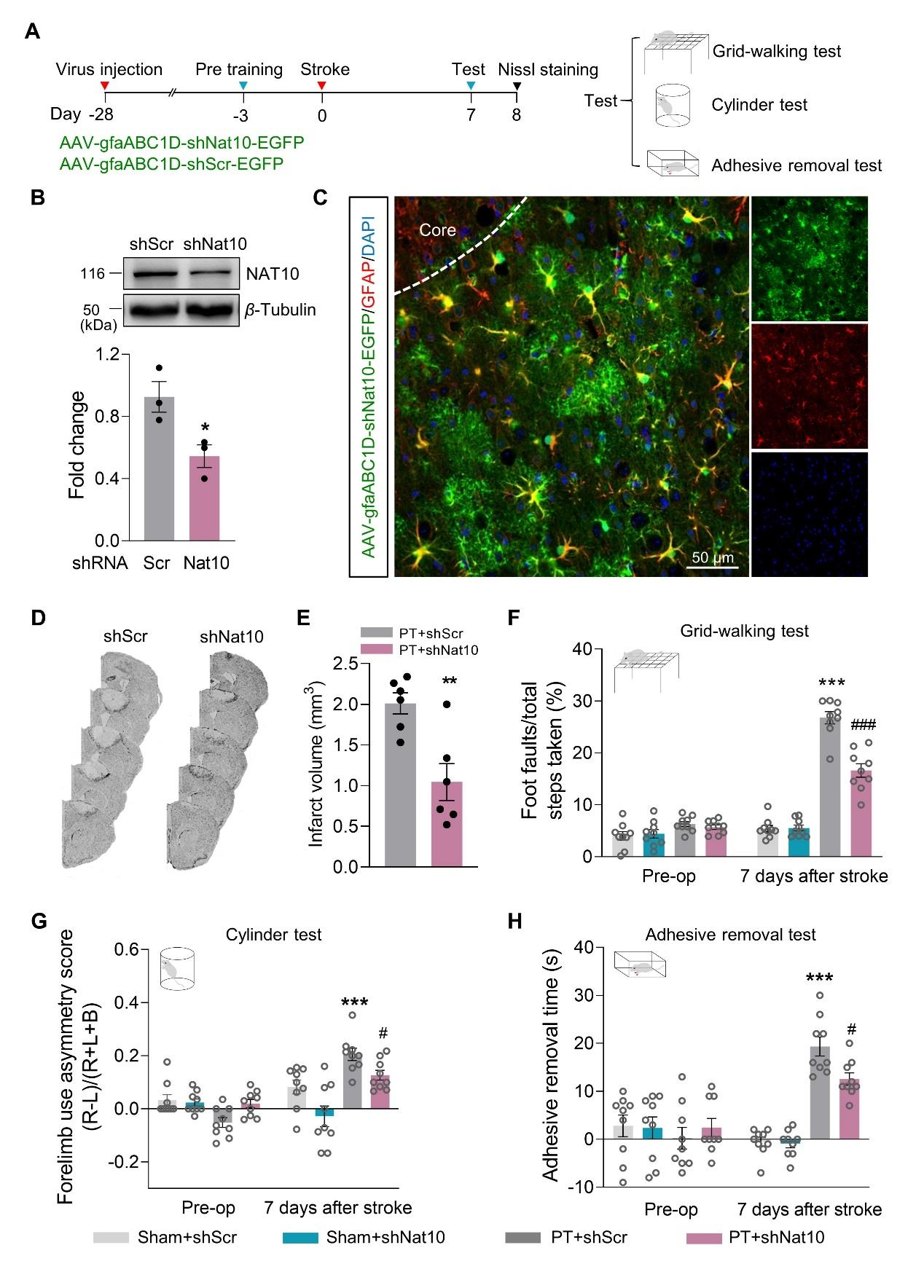 下调星形胶质细胞的NAT10表达可促进PT小鼠功能恢复