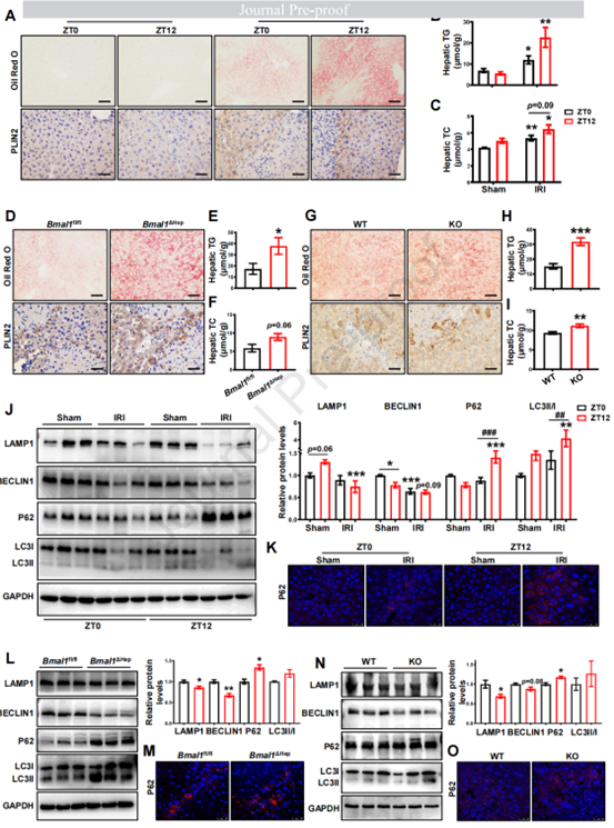 BMAL1/HSD17B13轴通过促进自噬和减轻脂质积累参与HIRI