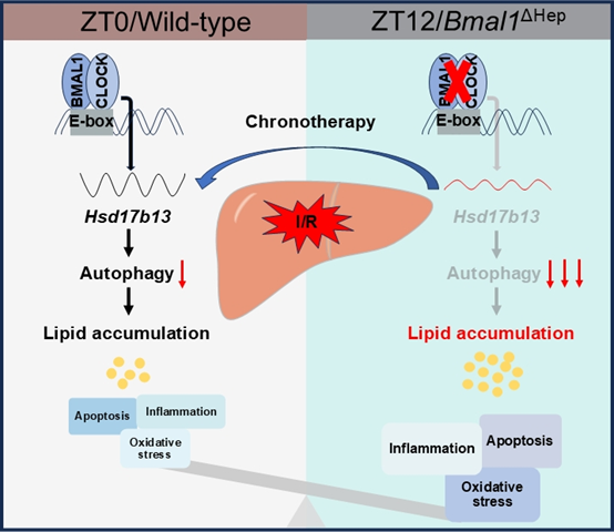 HSD17B13介导的肝细胞自噬对HIRI的昼夜节律控制