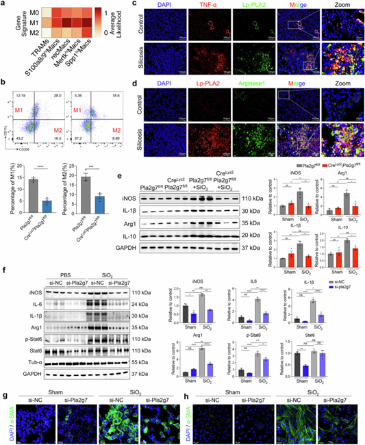 Pla2g7基因缺失抑制硅肺小鼠及SiO₂诱导的巨噬细胞分化