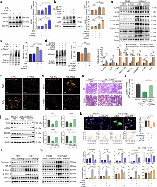 Lp-PLA2-CL通路在SiO₂诱导的巨噬细胞及SiglecFloAM中诱导线粒体自噬功能障碍