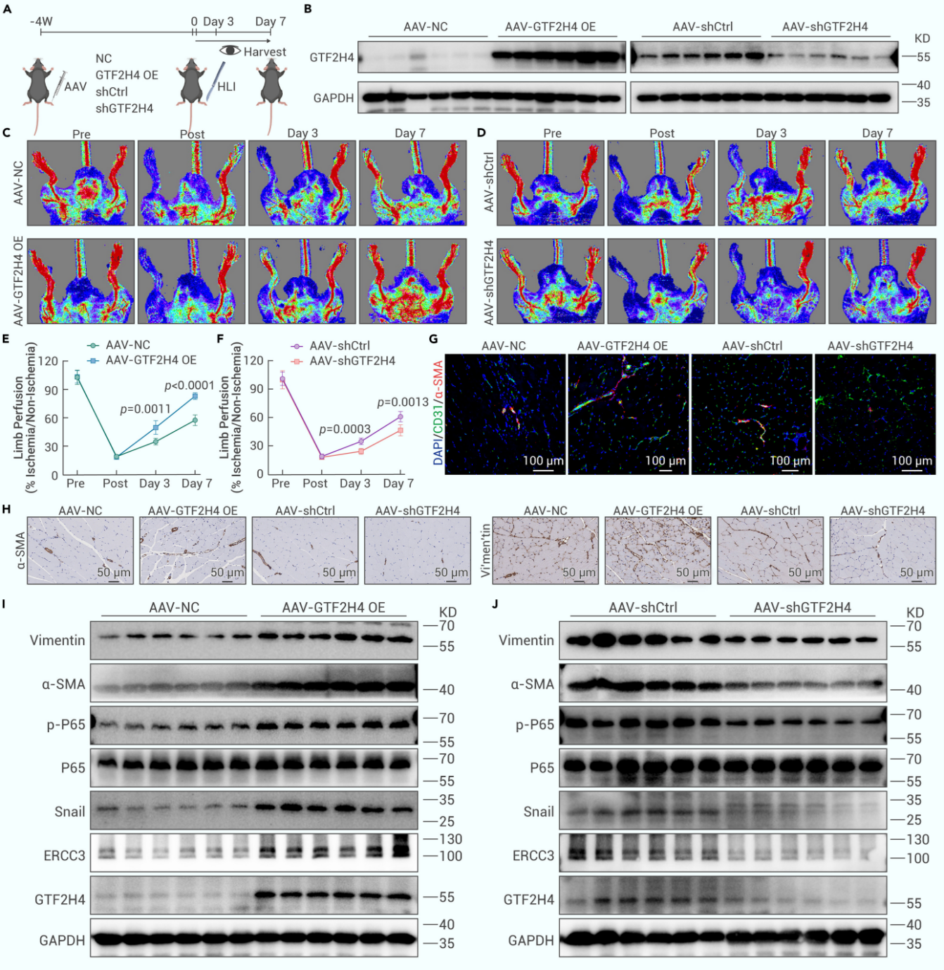 GTF2H4促进体内部分EndMT并改善缺血后损伤后血流恢复