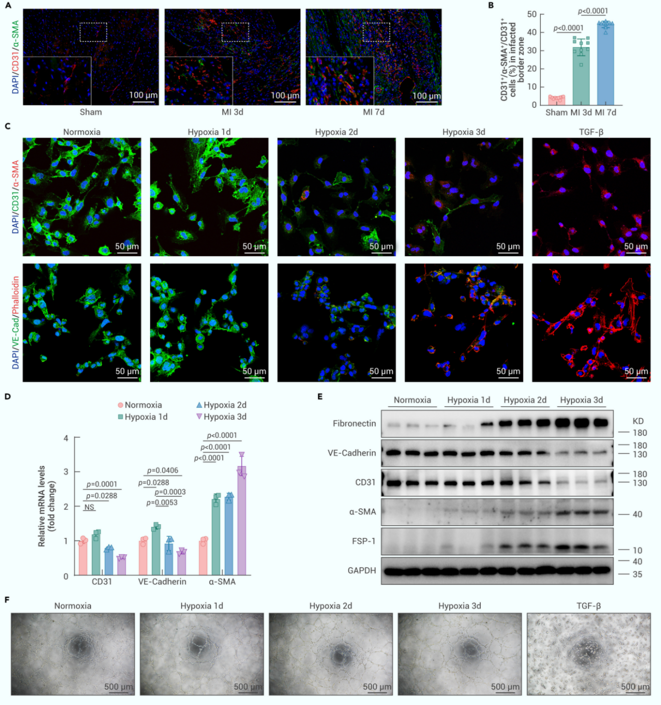 缺血/缺氧诱发部分EndMT