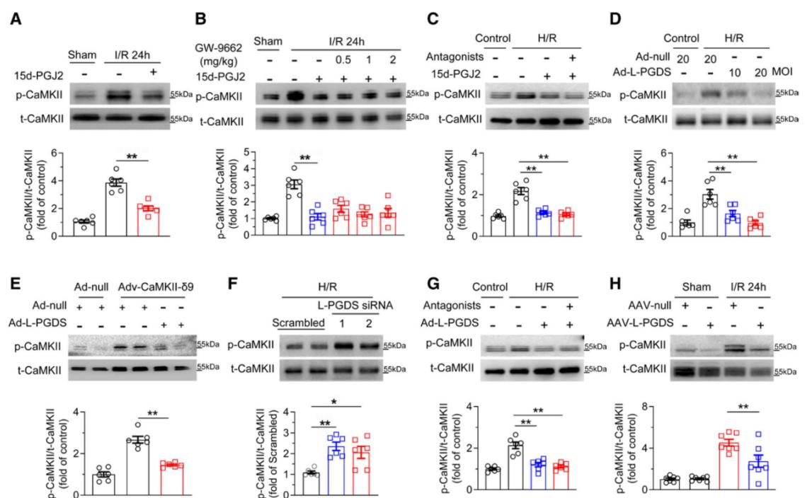 L-PGDS/15d-PGJ2信号轴抑制I/R诱导的CaMKII激活