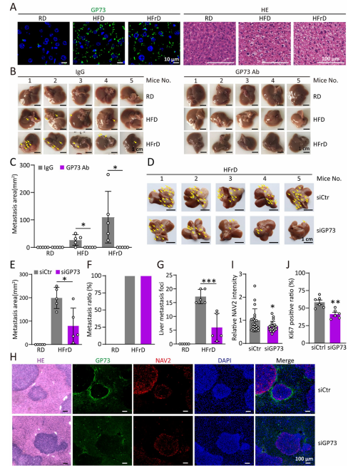 靶向GP73可抑制高脂或高果糖喂养引起的CRC肝转移