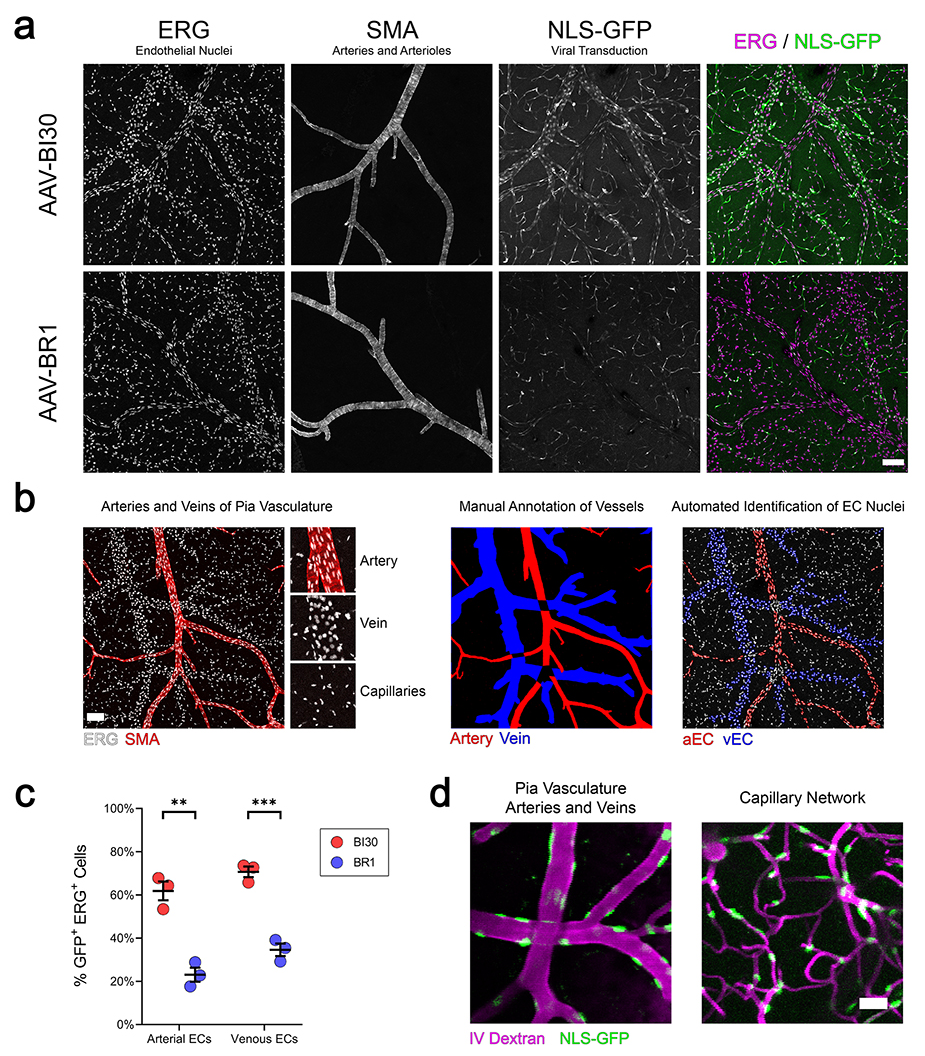左：AAV-BR1经尾静脉注射靶向感染大脑；右：AAV-BRA1感染脑内皮细胞