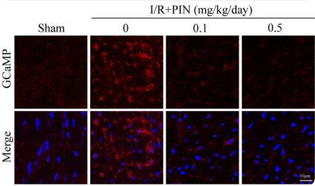 AAV9-Cdh5-GCaMP8感染小鼠心脏微血管内皮并监测其钙水平变化