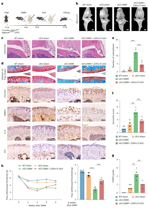 ZDHHC11可减轻Zdhhc11 cKO-DMM小鼠的侵袭性OA表