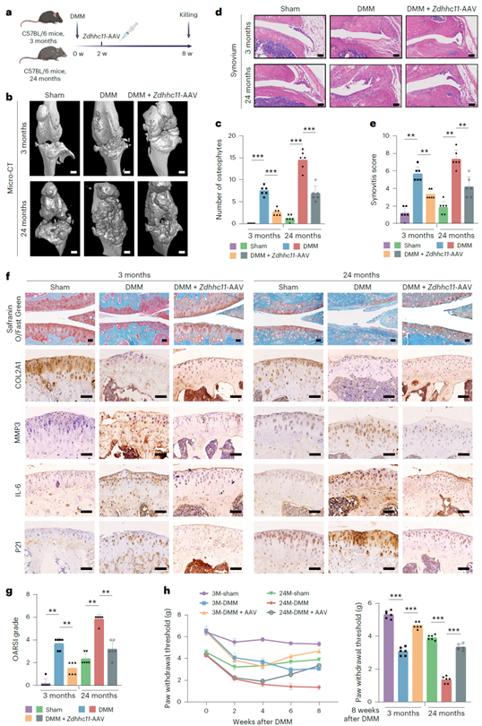 ZDHHC11在体内可缓解与年龄相关的OA病理表型