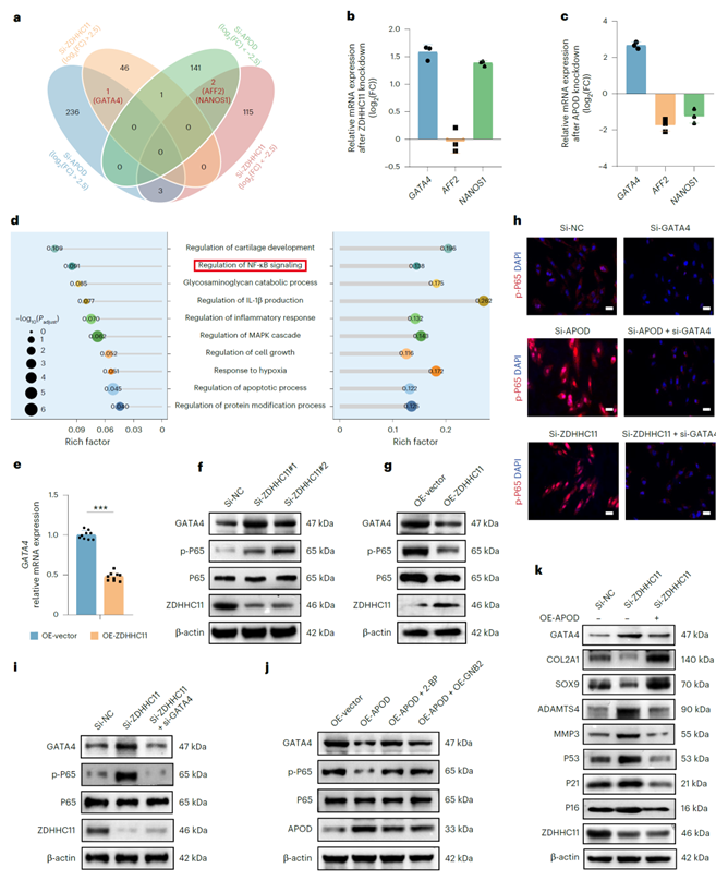 ZDHHC11介导的棕榈酰化通过抑制GATA4-P65信号通路缓解OA进展