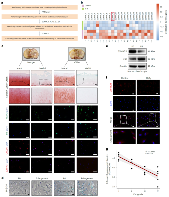 ZDHHC11在老年OA患者及衰老软骨细胞中的表达下调