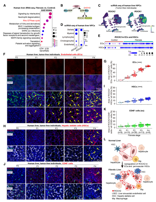 ROCK2在人纤维化肝脏的血管内皮细胞及血管周围肝星状细胞中表达上调