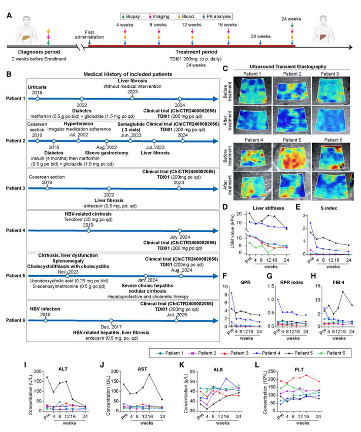 扩展的临床试验数据显示TDI01在6名受试患者中减轻了肝纤维化